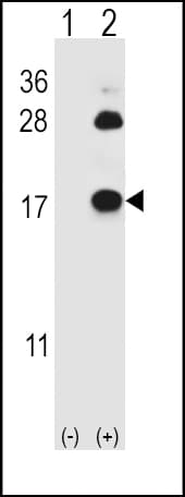 IHC-plus™ FABP4 / AP2 Antibody (Tyr20)