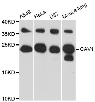 CAV1 / Caveolin 1 Antibody