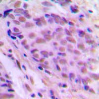 ELL / MEN Antibody (Internal)