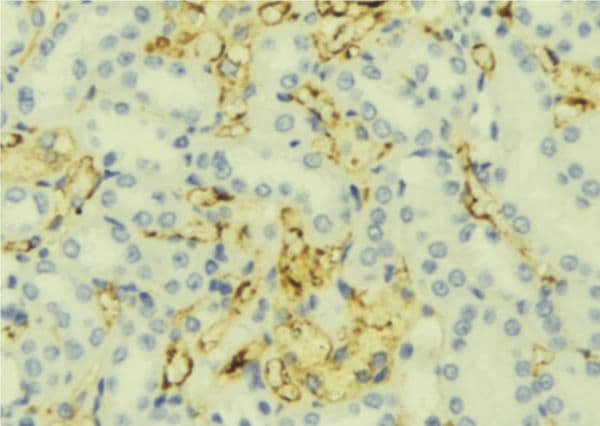 RPGR Antibody