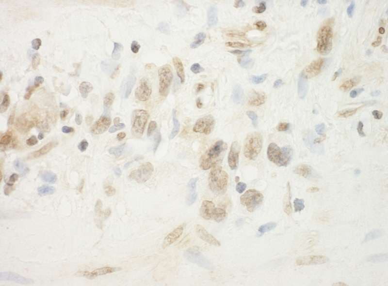IHC-plus™ FLCN / Folliculin Antibody (aa1-50)
