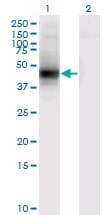 IHC-plus™ DCN / Decorin Antibody (clone 3H4-1F4)