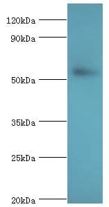 GPS1 / CSN1 Antibody (aa222-491)