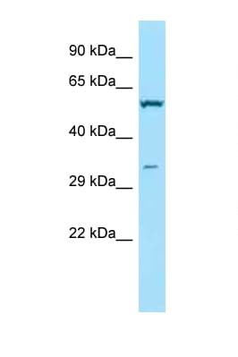 TPMT Antibody (aa152-201)