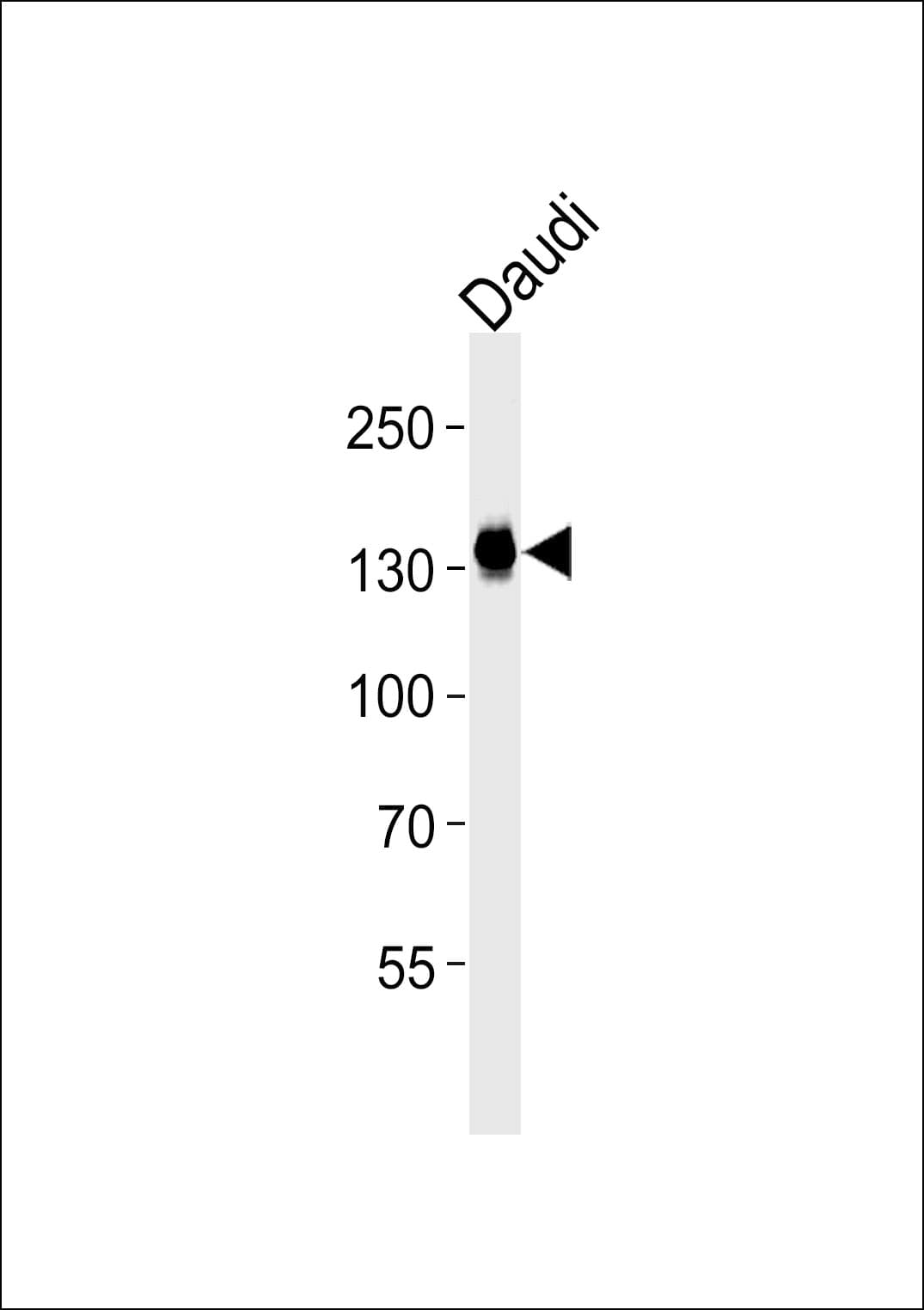 USP25 Antibody (clone 1277CT376.106.171)
