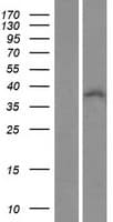 ZNF32 Protein (Over-Expression Lysate Myc-DDK (Flag))