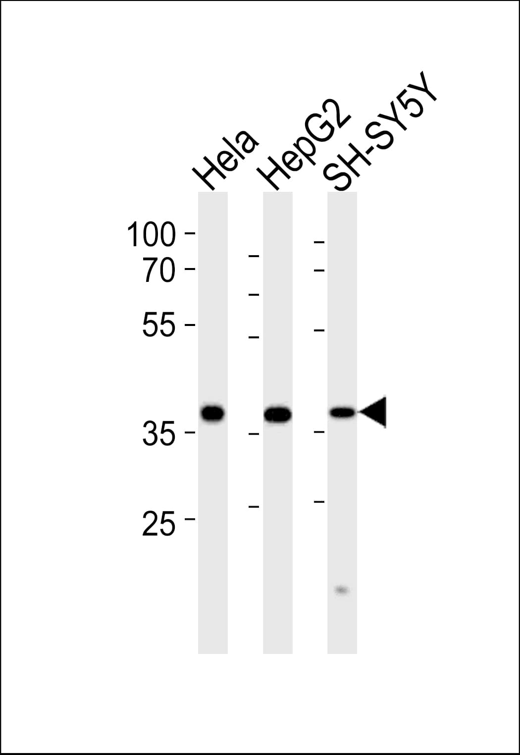 TIMM50 Antibody (aa25-56)