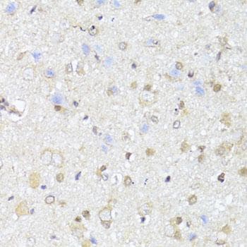 Polyclonal Rabbit anti-Human EGLN1 + EGLN2 Antibody (IHC)