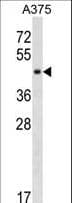 SUGT1 / SGT1 Antibody (aa330-356)