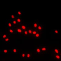 BACH1 Antibody (Internal)