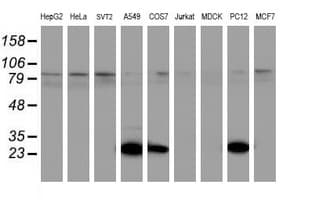 UCHL1 / PGP9.5 Antibody (clone OTI2B5, Carrier-free)