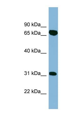 Polyclonal Rabbit anti-Human HIRIP3 Antibody (aa395-444, WB)