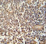 AIMP1 / EMAP II Antibody (aa242-268)