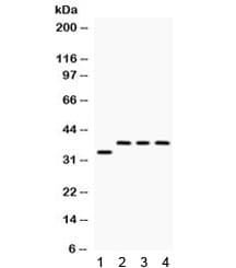 Polyclonal Rabbit anti-Human PPP1R1B / DARPP-32 Antibody (IHC, WB)