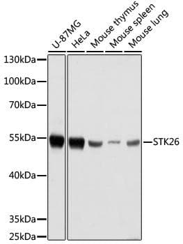 Polyclonal Rabbit anti-Human STK26 / MST4 Antibody (WB)