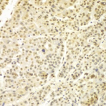 LMNA / Lamin A+C Antibody