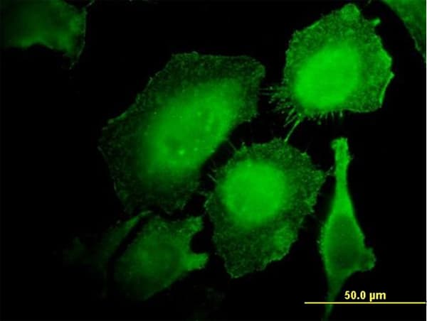 Monoclonal Mouse anti-Human HCLS1 Antibody (clone 2A9, IHC, IF, WB)