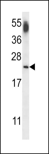 CNRIP1 Antibody (aa76-104)