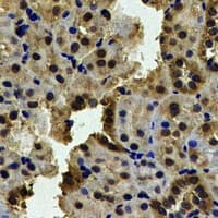 KHK / Ketohexokinase Antibody