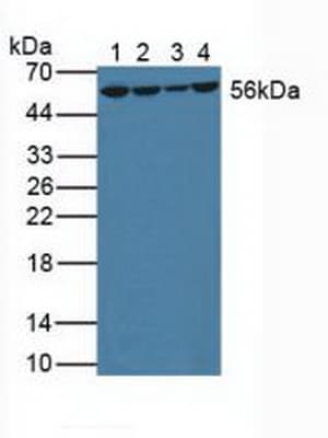 GSR / Glutathione Reductase Antibody (aa44-522)