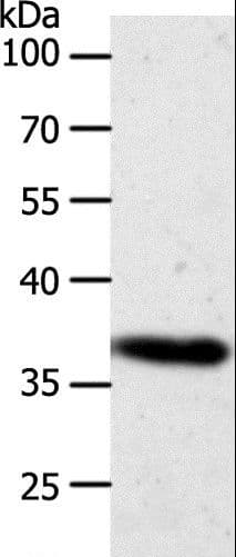 Polyclonal Rabbit anti-Human AKR1B1 / Aldose Reductase Antibody (IHC, WB)