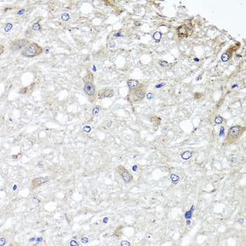 Polyclonal Rabbit anti-Human METTL13 / KIAA0859 Antibody (IHC, WB)