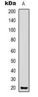 CMTM8 Antibody (Internal)