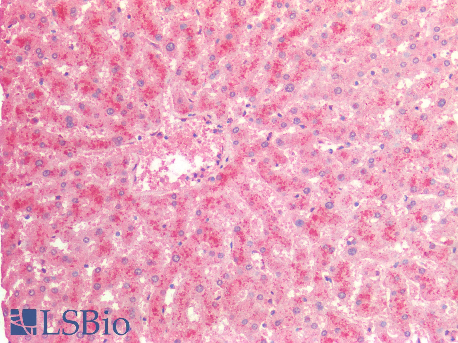 IHC-plus™ Polyclonal Rabbit anti-Human ADCY3 / Adenylate Cyclase 3 Antibody (IHC, IF, WB)