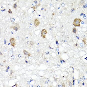 Polyclonal Rabbit anti-Human RBP2 / CRBPII Antibody (IHC, IF, WB)
