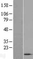 ACYP1 Protein (Over-Expression Lysate Myc-DDK (Flag))