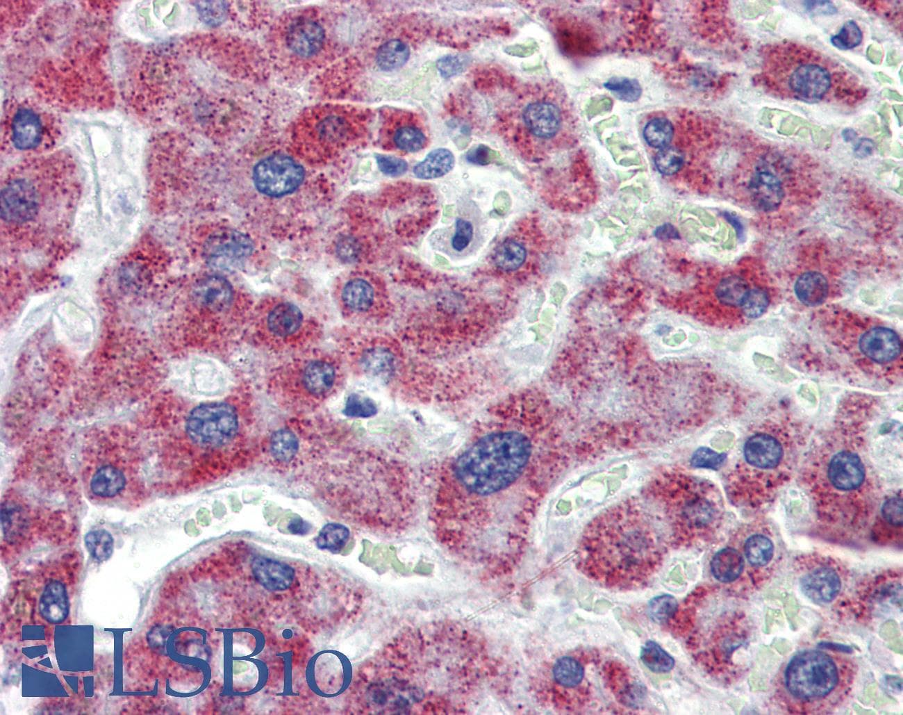 Polyclonal Rabbit anti-Human ACAA1 Antibody (aa36-85, IHC, WB)