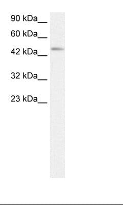 CCR8 / CD198 Antibody (aa163-212, FITC)