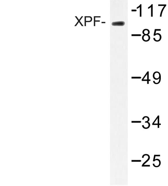ERCC4 / XPF Antibody (Ala822)