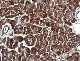 BBOX1 / BBOX Antibody (clone OTI4F9)