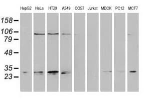 NNMT Antibody (clone OTI1A1)