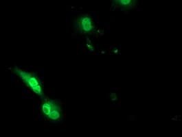 EPM2AIP1 Antibody (clone OTI6H5)