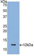 Proteoglycan 4 / Lubricin Antibody (aa1151-1241)