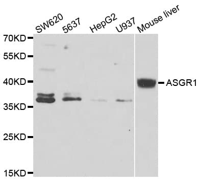 IHC-plus™ ASGR1 / ASGPR Antibody