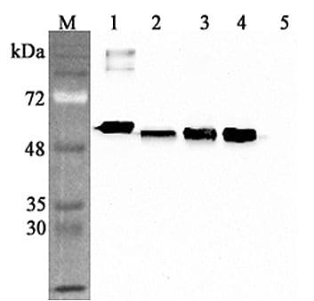 CALR / Calreticulin Antibody
