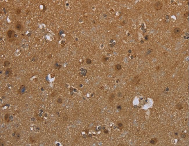 Polyclonal Rabbit anti-Human SCGB1D2 / Lipophilin B Antibody (IHC)