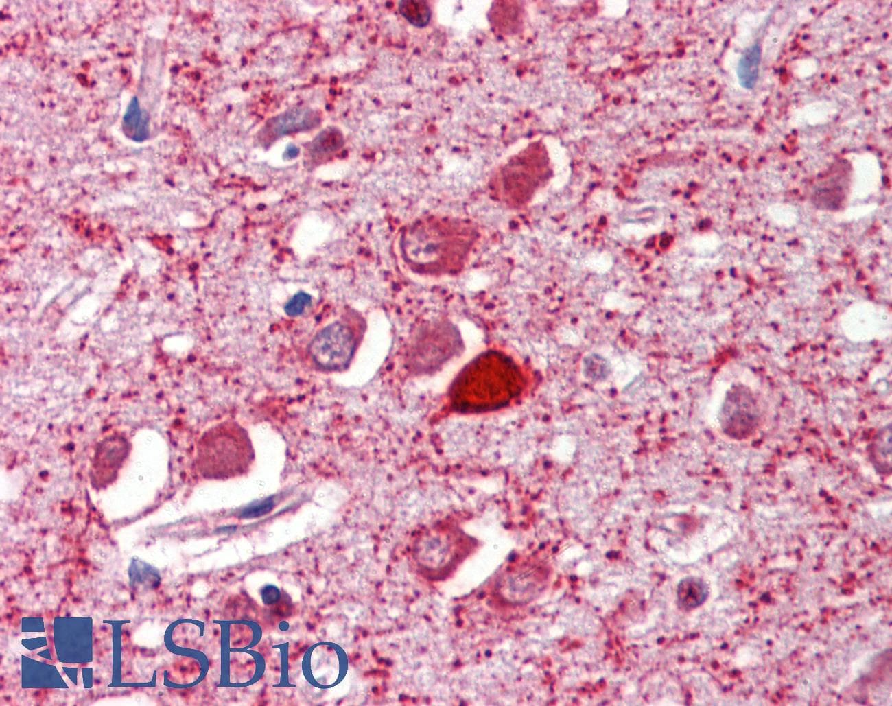 IHC-plus™ Polyclonal Goat anti-Human PVALB / Parvalbumin Antibody (aa99-110, IHC, WB)