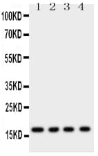 MB / Myoglobin Antibody (aa138-154)