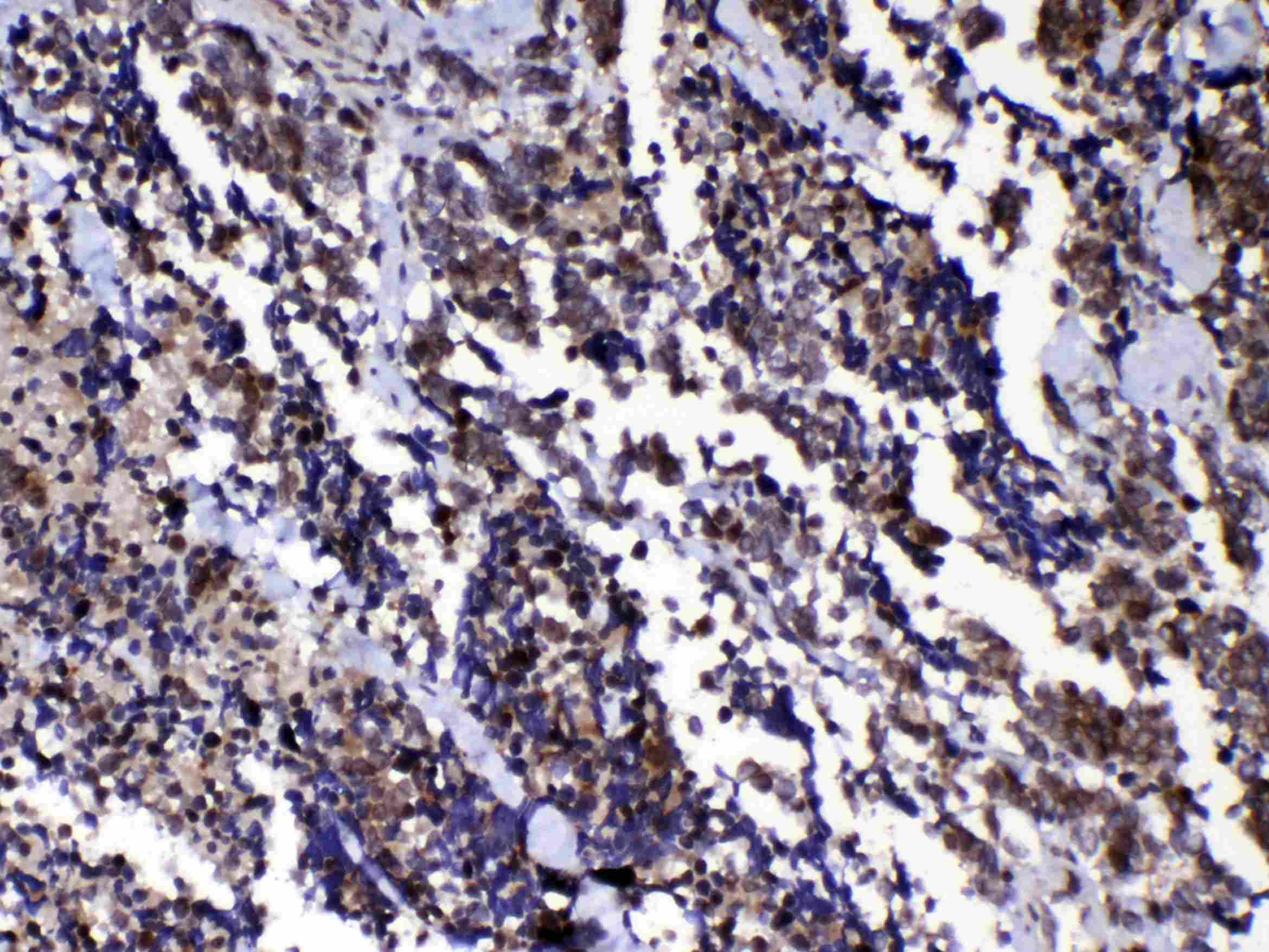 RAN Antibody