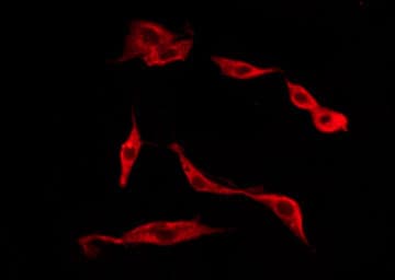 Polyclonal Rabbit anti-Human TACR1 / NK1R Antibody (IHC, IF, WB)