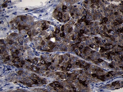 Monoclonal Mouse anti-Human RRM2 Antibody (clone OTI1F2, Carrier-free, IHC, WB)