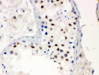 MNAT1 Antibody