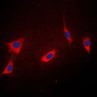 PPIF / Cyclophilin F Antibody (Internal)