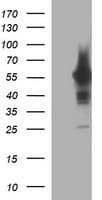 TH / Tyrosine Hydroxylase Antibody (clone OTI3G3)