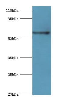 PKLR Antibody (aa1-574)