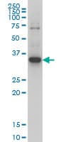 ZIC4 Antibody (clone 1A9)